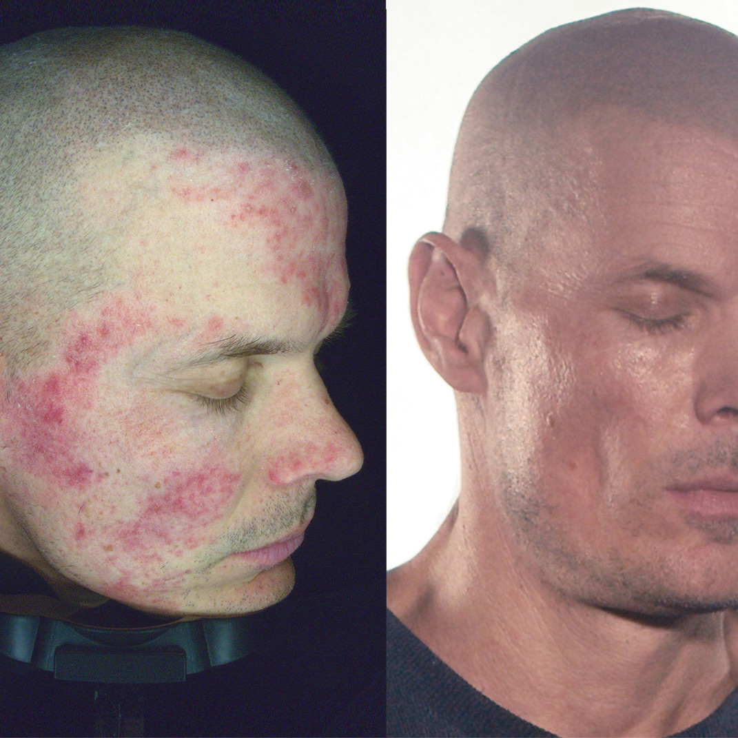 skin-square